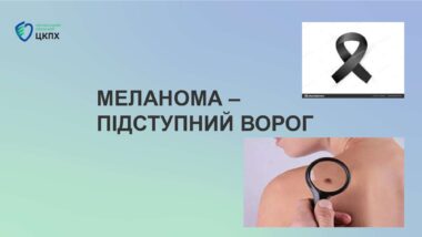 МЕЛАНОМА - підступний ворог