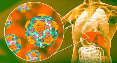 Гострий вірусний гепатит А