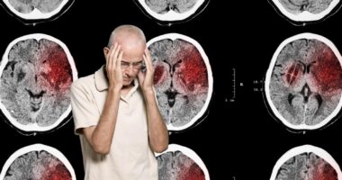 Інсульт: що варто знати кожному