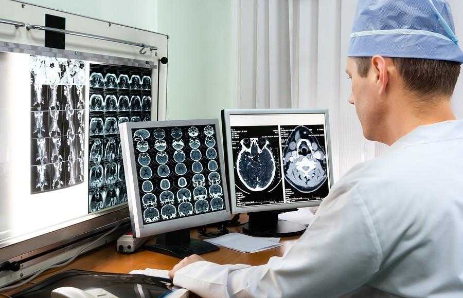 Інсульт: що варто знати кожному